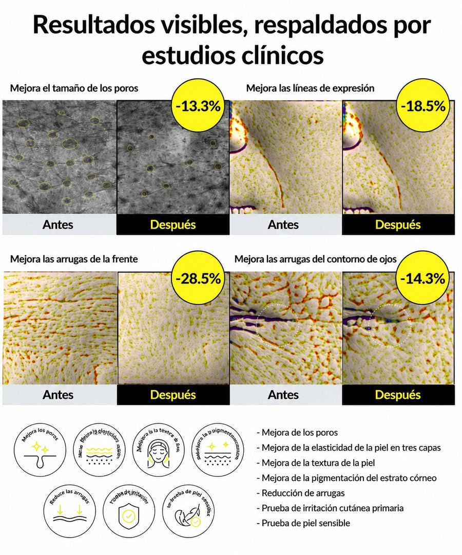 Antes y después