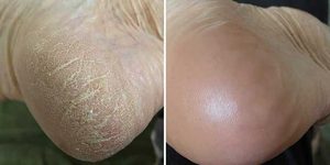 Resultado del cliente