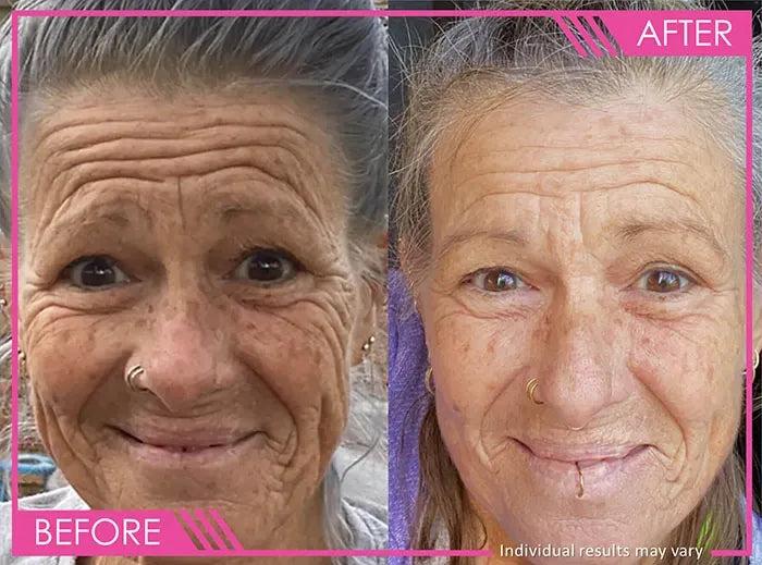 Antes y después